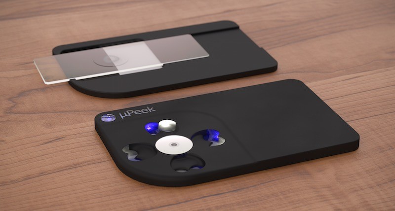 Credit Card-Sized µPeek Turns Your Phone into a Microscope