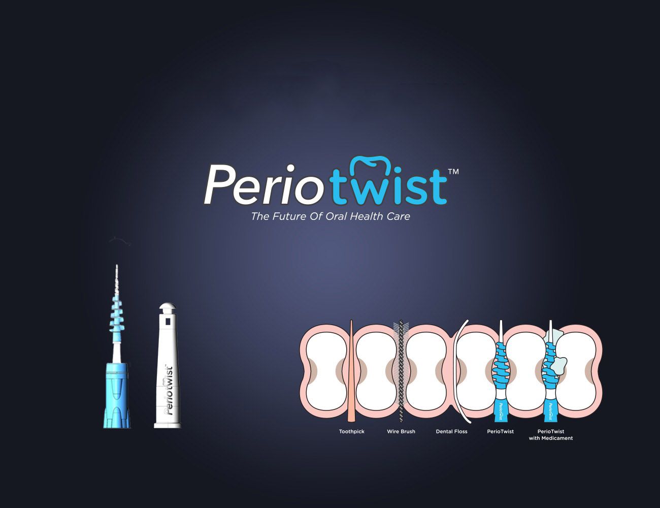 PerioTwist – A Future Without Flossing