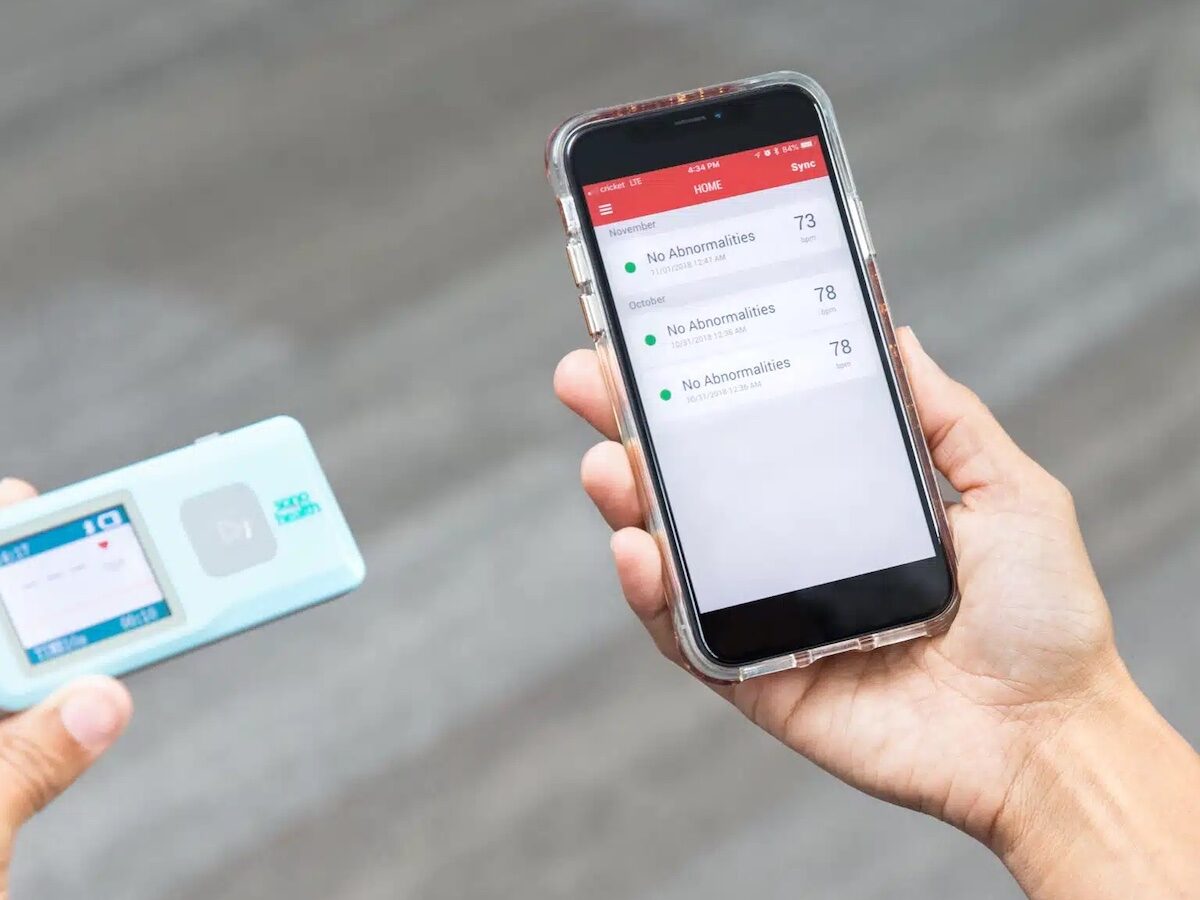 EKGraph: Portable EKG Monitor with Bluetooth Control by SonoHealth on Gadget Flow