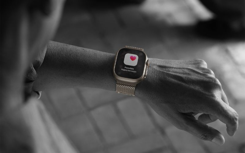 Apple Watch Ultra 3